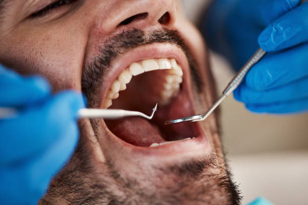 Best Emergency Denture Repair in Tchula, MS