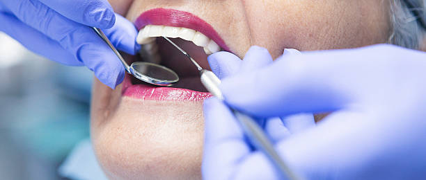 Best Urgent Care for Lost Fillings or Crowns in Tchula, MS